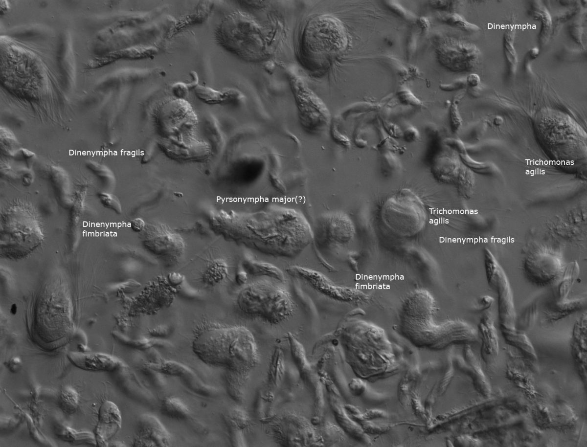 Termite gut microbes | MICROBES AND MORE | University of Connecticut